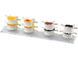 Erler-Zimmer �ŊԔϐ��ǃ��f�� 8-637-01