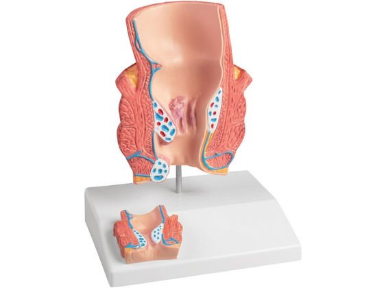 Erler-Zimmer ���j���f�� 8-636-01